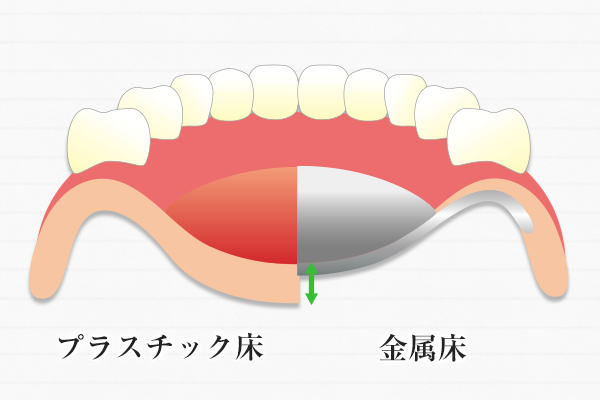 豊田歯科クリニック | 入れ歯