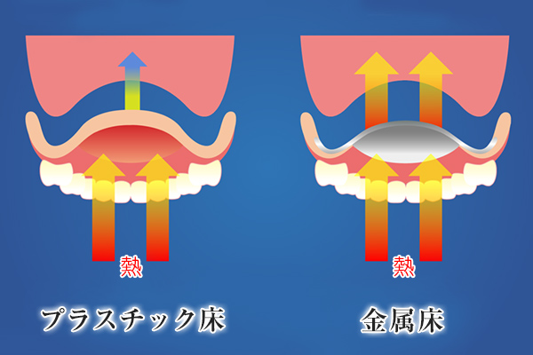 豊田歯科クリニック | 入れ歯